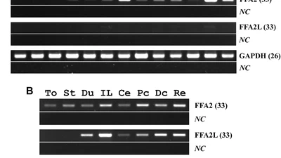 Identification and characterization of the free fatty acid receptor 2 (FFA2) and a novel functional FFA2-like receptor (FFA2L) for short-chain fatty acids in pigs: Evidence for the existence of a duplicated FFA2 gene (FFA2L) in some mammalian species featured image